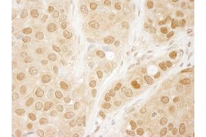 Immunohistochemistry (IHC) image for anti-V-Akt Murine Thymoma Viral Oncogene Homolog 1 (AKT1) (AA 25-75) antibody (ABIN7448406)