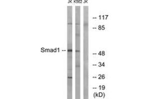 Western blot analysis of extracts from Jurkat/K562 cells, using Smad1 (Ab-187) Antibody. (SMAD1 抗体  (AA 153-202))