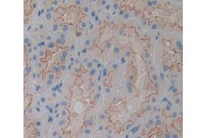 Used in DAB staining on fromalin fixed paraffin- embedded kidney tissue (PTPMT1 抗体  (AA 71-197))