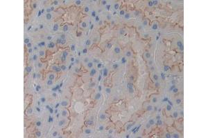 Used in DAB staining on fromalin fixed paraffin- embedded kidney tissue (PTPMT1 抗体  (AA 71-197))