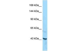 Western Blotting (WB) image for anti-Receptor Tyrosine Kinase-Like Orphan Receptor 1 (ROR1) (C-Term) antibody (ABIN2789668) (ROR1 抗体  (C-Term))