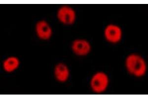 ABIN6274287 staining RAW264. (CEBPG 抗体  (Internal Region))