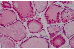 Human Thyroid: Formalin-Fixed, Paraffin-Embedded (FFPE) (Peroxiredoxin 1 抗体  (AA 1-184))