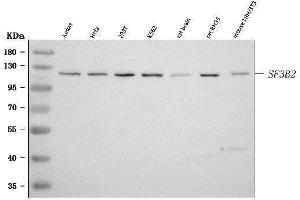 Western blot analysis of SF3B2 using anti-SF3B2 antibody (ABIN7600769).