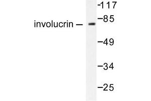 Image no. 1 for anti-Involucrin (IVL) antibody (ABIN265482) (Involucrin 抗体)