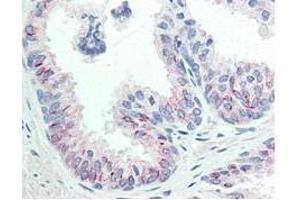 Immunohistochemistry (IHC) image for anti-V-Akt Murine Thymoma Viral Oncogene Homolog 1 (AKT1) (pSer473) antibody (ABIN964561)