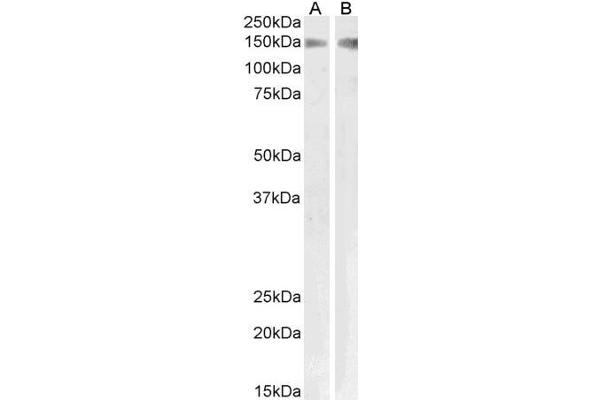 PLA2R1 抗体  (Internal Region)