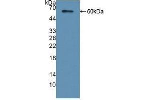 Detection of Recombinant CAP2, Human using Polyclonal Antibody to Adenylyl Cyclase Associated Protein 2 (CAP2) (CAP2 抗体  (AA 1-477))
