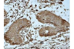 IHC analysis of formalin-fixed paraffin-embedded fetal testis showing cytoplasmic staining, using MEI1 antibody (1/100 dilution).