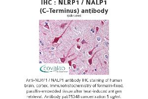 Image no. 1 for anti-NLR Family, Pyrin Domain Containing 1 (NLRP1) antibody (ABIN1737385) (NLRP1 抗体)