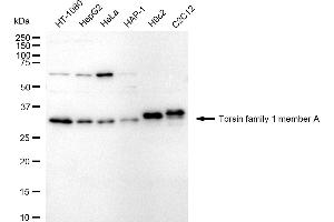 anti-Torsin Family 1, Member A (Torsin A) (TOR1A) antibody