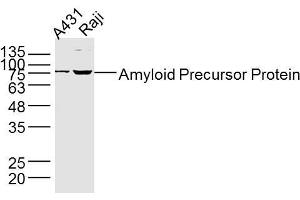 Lane 1: A431 lysates Lane 2: Raji lysates Jurkat lysates probed with Amyloid Precursor Protein Antibody, Unconjugated  at 1:300 dilution and 4˚C overnight incubation. (APP 抗体  (AA 381-480))