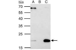 IP Image Sorcin antibody [N1C3] immunoprecipitates Sorcin protein in IP experiments. (SRI 抗体)