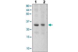 The tissue lysates derived from mouse liver (Lane 1), mouse muscle (Lane 2) were immunoprobed by SOCS3 polyclonal antibody  at 1 : 500. (SOCS3 抗体  (C-Term))
