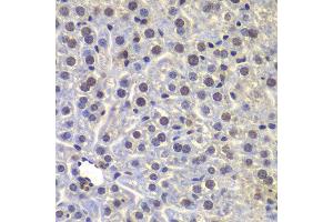 Immunohistochemistry of paraffin-embedded mouse liver using FUBP3 antibody at dilution of 1:100 (40x lens). (FUBP3 抗体)