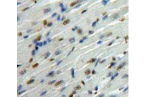 Used in DAB staining on fromalin fixed paraffin-embedded Heart tissue (SMAD6 抗体  (AA 261-495))