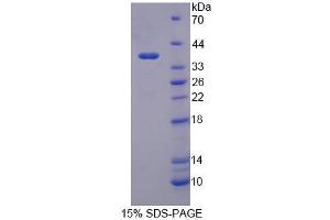 Image no. 1 for Pregnancy Specific beta 1 Glycoprotein 2 (PSG2) (AA 35-335) protein (His tag) (ABIN6237544)
