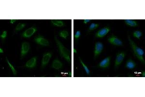 ICC/IF Image PRKCSH antibody detects PRKCSH protein at endoplasmic reticulum by immunofluorescent analysis. (PRKCSH 抗体)