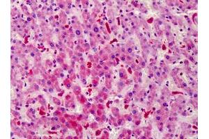 Human Liver: Formalin-Fixed, Paraffin-Embedded (FFPE) (STEAP4 抗体)