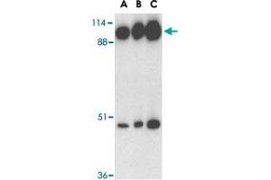 Western blot analysis of ACE2 in human kidney tissue lysate with ACE2 polyclonal antibody  at 0. (ACE2 抗体  (C-Term))