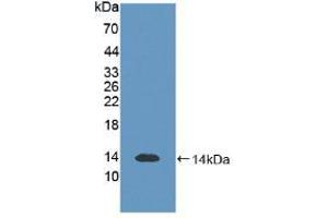 Western blot analysis of recombinant Human S100B. (S100B 抗体  (AA 1-92))