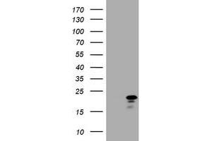 Image no. 1 for anti-Cyclin-Dependent Kinase Inhibitor 2C (p18, Inhibits CDK4) (CDKN2C) antibody (ABIN1497450) (CDKN2C 抗体)