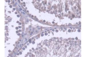 DAB staining on IHC-P; Samples: Rat Testis Tissue (RNASEH2A 抗体  (AA 1-301))