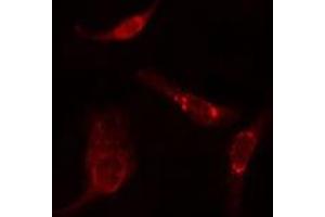 ABIN6275791 staining  HuvEc cells by IF/ICC. (TUBA3C/E 抗体)