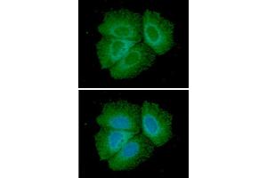 ICC/IF analysis of Adiponectin in Hep3B cells line, stained with DAPI (Blue) for nucleus staining and monoclonal anti-human Adiponectin antibody (1:100) with goat anti-mouse IgG-Alexa fluor 488 conjugate (Green). (ADIPOQ 抗体)