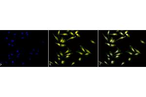 Immunocytochemistry/Immunofluorescence analysis using Rabbit Anti-Calreticulin Polyclonal Antibody (ABIN361834 and ABIN361835). (Calreticulin 抗体)