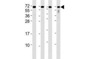 Western blot testing of CD63 antibody at 1:2000 dilution. (CD63 抗体  (AA 163-190))