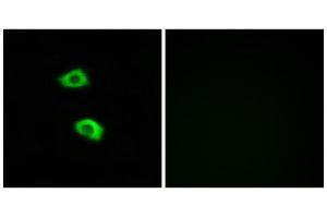 Immunofluorescence analysis of LOVO cells, using OR51B5 antibody. (OR51B5 抗体  (Internal Region))