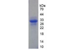 SDS-PAGE analysis of Human XPG Protein. (ERCC5 蛋白)