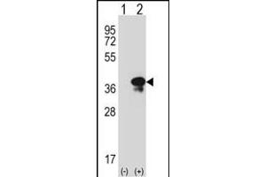 Western blot analysis of STX3 (arrow) using rabbit polyclonal STX3 Antibody (Center) (ABIN389321 and ABIN2839439). (STX3 抗体  (AA 178-205))