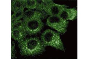 Immunofluorescence staining of A431 cells (Human epithelial carcinoma, ATCC CRL-1555). (HSPA4 抗体  (AA 703-858))