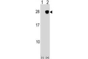 Western Blotting (WB) image for anti-UL16 Binding Protein 2 (ULBP2) antibody (ABIN2999200)