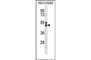 Western blot analysis of GPR109A Antibody (Center) in NCI-H292 cell line lysates (35ug/lane). (HCAR2 抗体  (Middle Region))