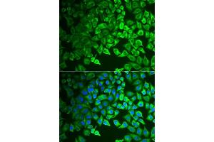Immunofluorescence analysis of  cells using GIF antibody (ABIN6130975, ABIN6141081, ABIN6141082 and ABIN6222649). (Intrinsic Factor 抗体  (AA 20-300))