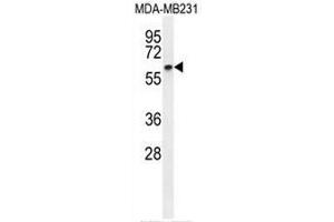 CCNB1 Antibody (C-term) western blot analysis in MDA-MB231 cell line lysates (35µg/lane). (Cyclin B1 抗体  (C-Term))