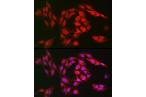 Immunofluorescence analysis of U2OS cells using SOD1 Rabbit pAb (ABIN3020854, ABIN3020855, ABIN3020856 and ABIN6213758) at dilution of 1:150 (40x lens). (SOD1 抗体  (AA 1-154))