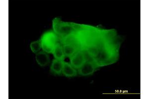 Immunofluorescence (IF) image for anti-ATPase, Ca++ Transporting, Cardiac Muscle, Fast Twitch 1 (ATP2A1) (AA 522-612) antibody (ABIN559993)