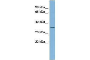 WB Suggested Anti-TTC35 Antibody Titration:  0. (TTC35 抗体  (Middle Region))