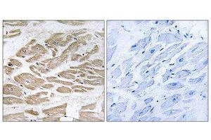 Immunohistochemistry (IHC) image for anti-Brain Protein 44-Like (BRP44L) (N-Term) antibody (ABIN1850936) (BRP44L 抗体  (N-Term))