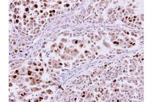 Immunohistochemistry (IHC) image for anti-Karyopherin alpha 2 (RAG Cohort 1, Importin alpha 1) (KPNA2) (C-Term) antibody (ABIN2856324)