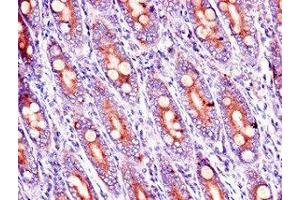 Immunohistochemistry of paraffin-embedded human small intestine tissue using ABIN7167318 at dilution of 1:100 (RAB39B 抗体  (AA 1-213))