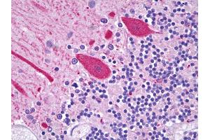 Anti-CES2 / Esterase antibody IHC of human brain, cerebellum, Purkinje cells. (CES2 抗体  (C-Term))