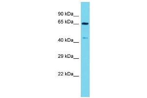 Host:  Rabbit  Target Name:  Arntl  Sample Type:  Mouse Stomach lysates  Antibody Dilution:  1. (ARNTL 抗体  (C-Term))