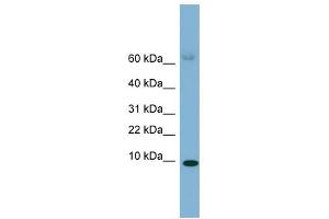 SAA4 antibody used at 1 ug/ml to detect target protein. (SAA4 抗体  (Middle Region))