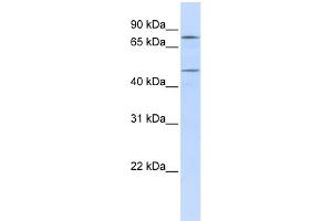 WB Suggested Anti-ERCC8 Antibody Titration: 0. (ERCC8 抗体  (N-Term))