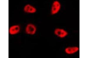Immunofluorescence (fixed cells) (IF/ICC) image for anti-Tumor Protein P53 (TP53) (N-Term) antibody (ABIN6263970)